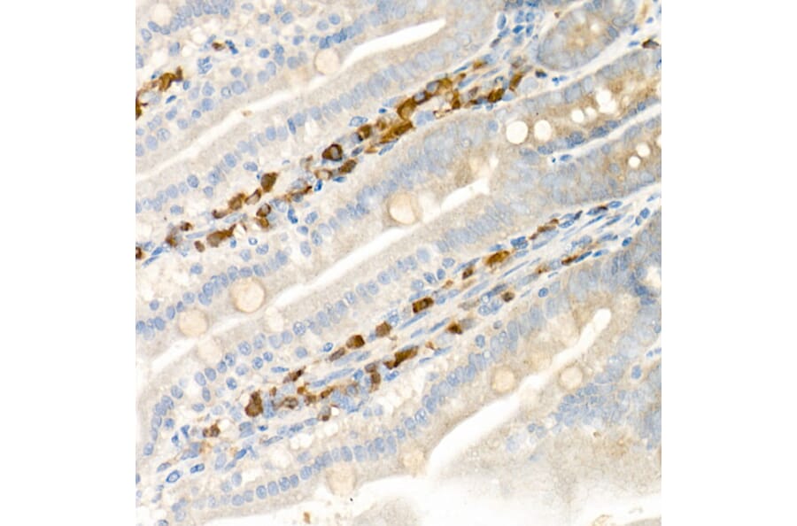 Immunohistochemistry - Anti-15 Lipoxygenase 1 Antibody (A15400) - Antibodies.com