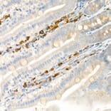 Immunohistochemistry - Anti-15 Lipoxygenase 1 Antibody (A15400) - Antibodies.com