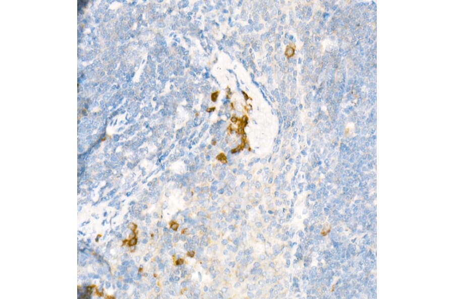 Immunohistochemistry - Anti-15 Lipoxygenase 1 Antibody (A15400) - Antibodies.com