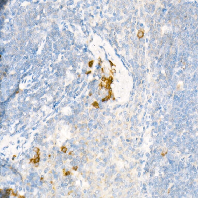 Immunohistochemistry - Anti-15 Lipoxygenase 1 Antibody (A15400) - Antibodies.com