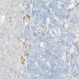 Immunohistochemistry - Anti-15 Lipoxygenase 1 Antibody (A15400) - Antibodies.com