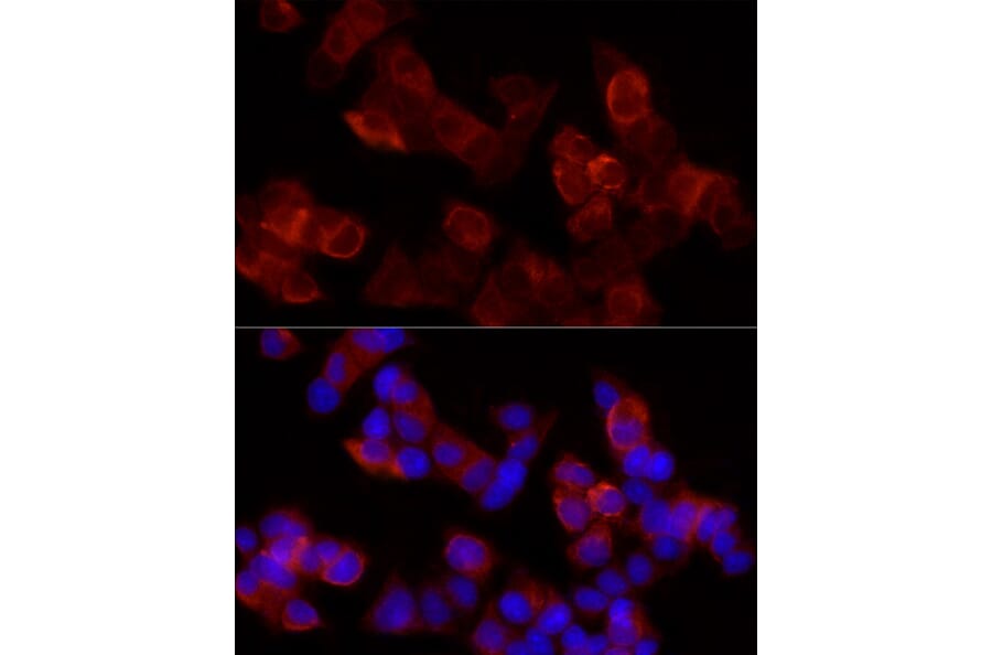 Immunofluorescence - Anti-15 Lipoxygenase 1 Antibody (A15400) - Antibodies.com
