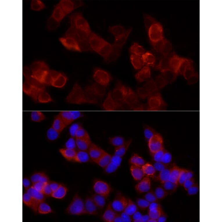 Immunofluorescence - Anti-15 Lipoxygenase 1 Antibody (A15400) - Antibodies.com