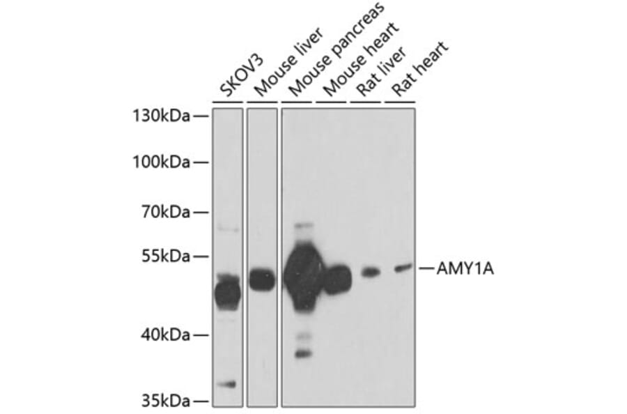 Western Blot - Anti-Salivary alpha amylase Antibody (A15401) - Antibodies.com