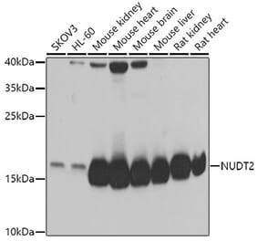 Western Blot - Anti-NUDT2 Antibody (A15402) - Antibodies.com