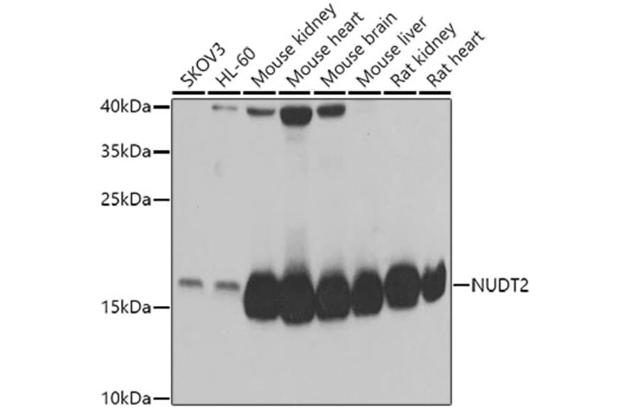 Western Blot - Anti-NUDT2 Antibody (A15402) - Antibodies.com