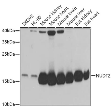 Western Blot - Anti-NUDT2 Antibody (A15402) - Antibodies.com