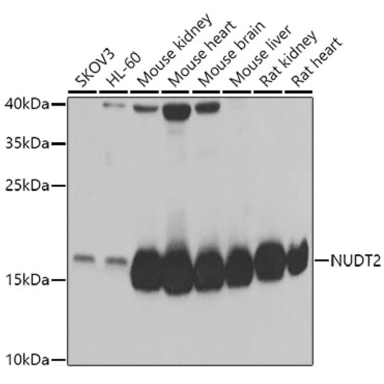 Western Blot - Anti-NUDT2 Antibody (A15402) - Antibodies.com