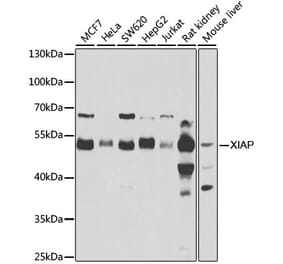 Western Blot - Anti-XIAP Antibody (A15403) - Antibodies.com