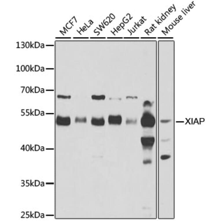 Western Blot - Anti-XIAP Antibody (A15403) - Antibodies.com