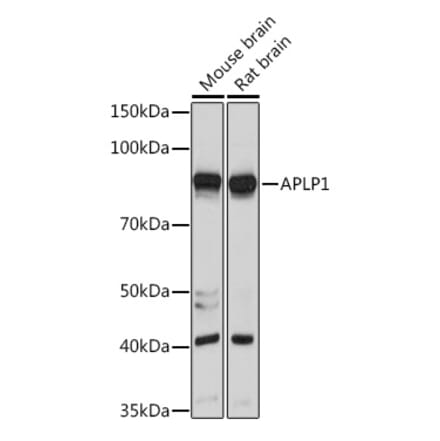 Western Blot - Anti-APLP1 Antibody (A15404) - Antibodies.com