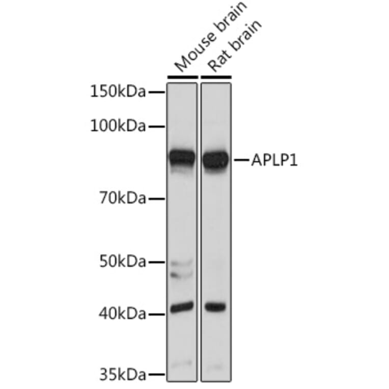 Western Blot - Anti-APLP1 Antibody (A15404) - Antibodies.com