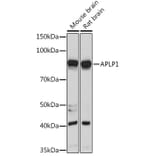 Western Blot - Anti-APLP1 Antibody (A15404) - Antibodies.com