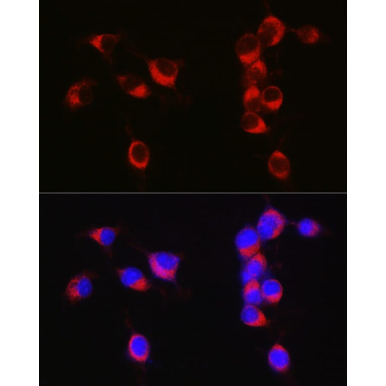 Immunofluorescence - Anti-APLP1 Antibody (A15404) - Antibodies.com