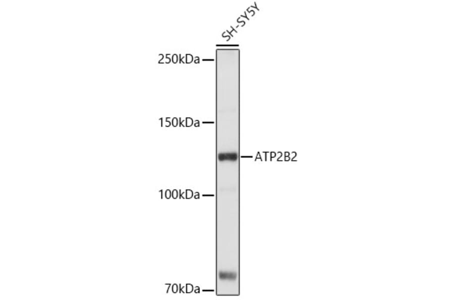 Western Blot - Anti-Calcium Pump PMCA2 ATPase Antibody (A15405) - Antibodies.com