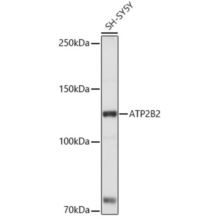 Western Blot - Anti-Calcium Pump PMCA2 ATPase Antibody (A15405) - Antibodies.com