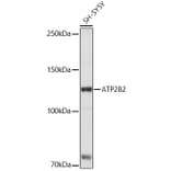 Western Blot - Anti-Calcium Pump PMCA2 ATPase Antibody (A15405) - Antibodies.com