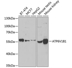 Western Blot - Anti-ATP6V1B1 Antibody (A15406) - Antibodies.com