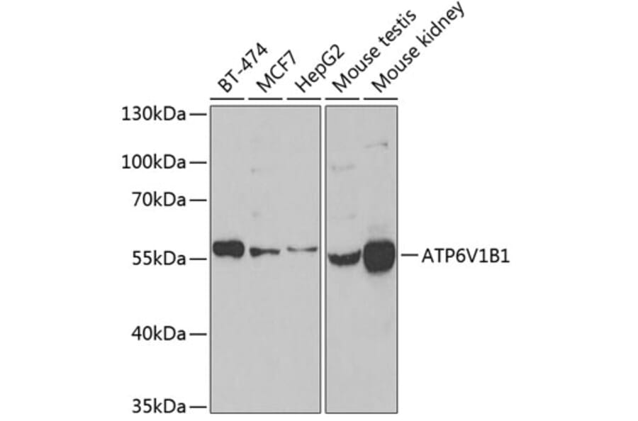Western Blot - Anti-ATP6V1B1 Antibody (A15406) - Antibodies.com