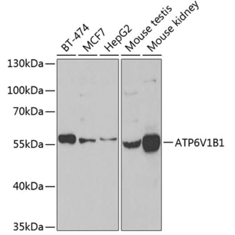 Western Blot - Anti-ATP6V1B1 Antibody (A15406) - Antibodies.com