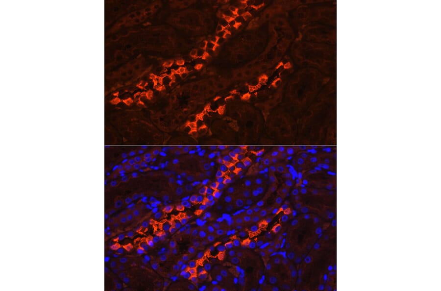 Immunofluorescence - Anti-ATP6V1B1 Antibody (A15406) - Antibodies.com