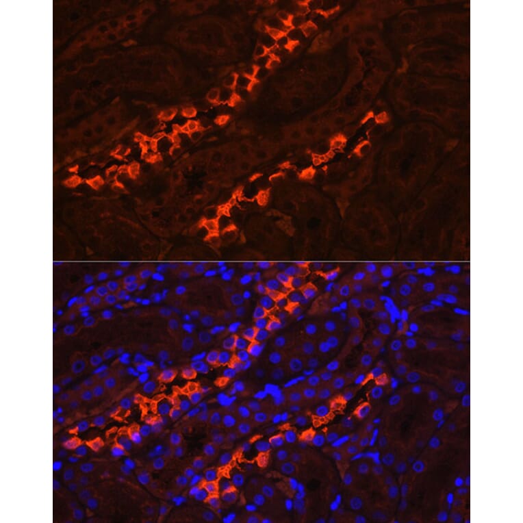 Immunofluorescence - Anti-ATP6V1B1 Antibody (A15406) - Antibodies.com
