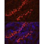 Immunofluorescence - Anti-ATP6V1B1 Antibody (A15406) - Antibodies.com