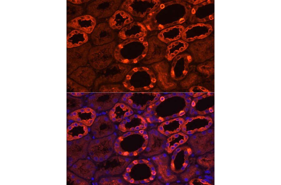 Immunofluorescence - Anti-ATP6V1B1 Antibody (A15406) - Antibodies.com