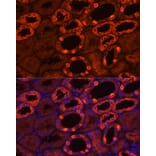Immunofluorescence - Anti-ATP6V1B1 Antibody (A15406) - Antibodies.com