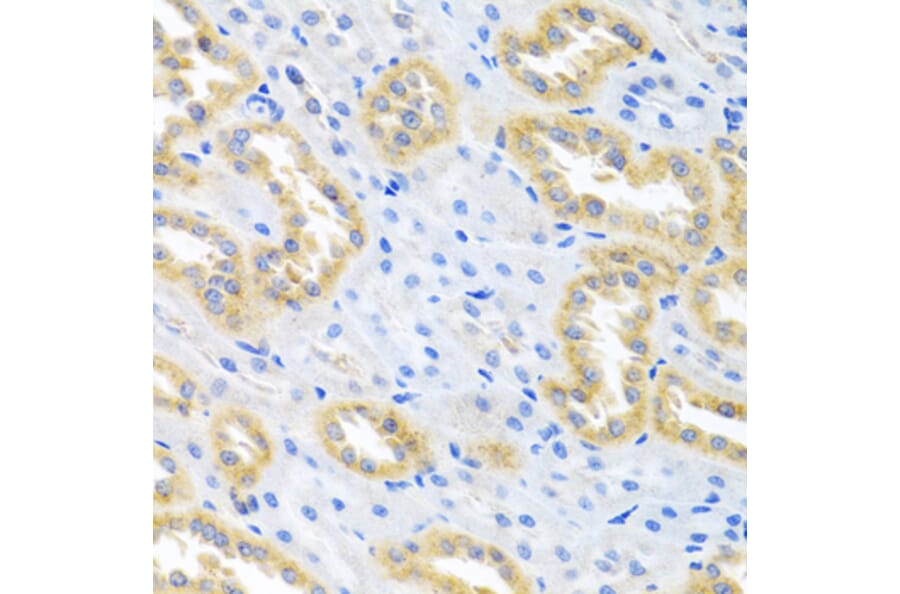 Immunohistochemistry - Anti-BMP3 Antibody (A15407) - Antibodies.com