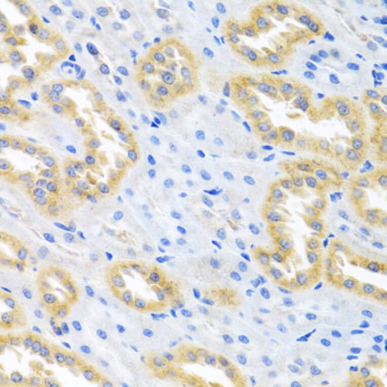Immunohistochemistry - Anti-BMP3 Antibody (A15407) - Antibodies.com