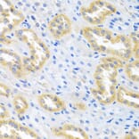 Immunohistochemistry - Anti-BMP3 Antibody (A15407) - Antibodies.com