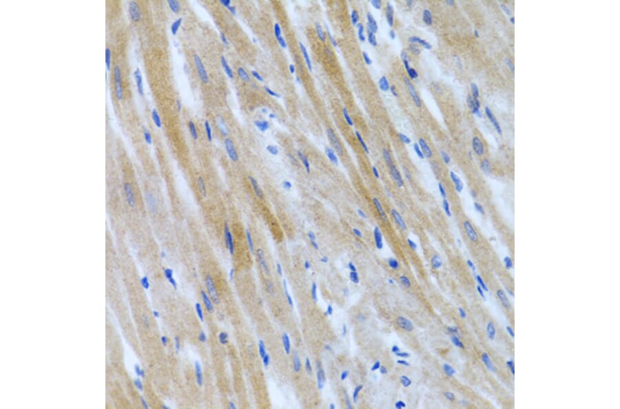 Immunohistochemistry - Anti-BMP3 Antibody (A15407) - Antibodies.com