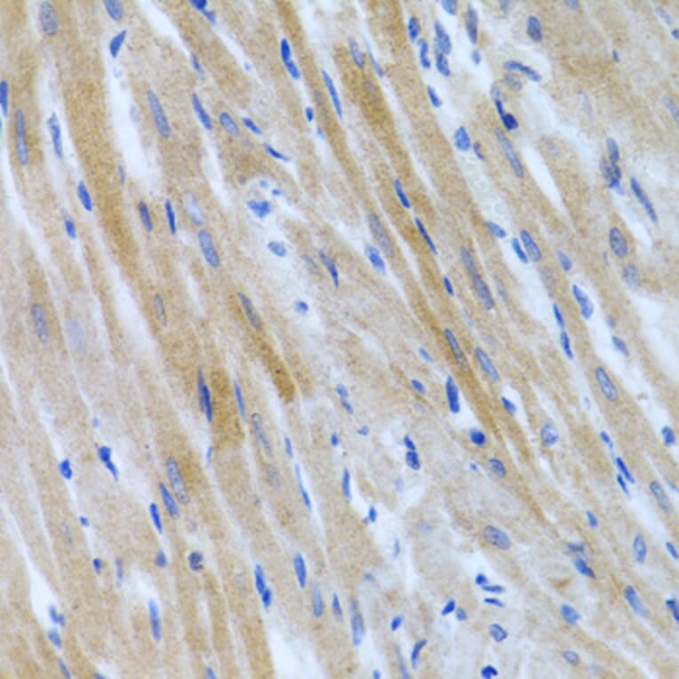Immunohistochemistry - Anti-BMP3 Antibody (A15407) - Antibodies.com