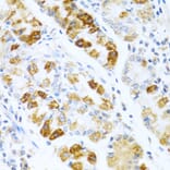 Immunohistochemistry - Anti-BMP3 Antibody (A15407) - Antibodies.com