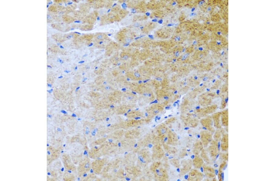 Immunohistochemistry - Anti-BMP3 Antibody (A15407) - Antibodies.com