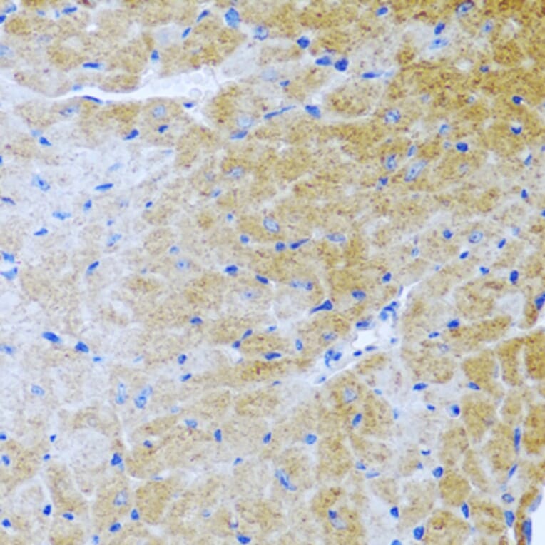 Immunohistochemistry - Anti-BMP3 Antibody (A15407) - Antibodies.com