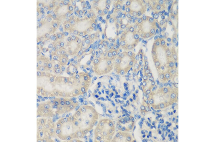 Immunohistochemistry - Anti-C3 Antibody (A15408) - Antibodies.com