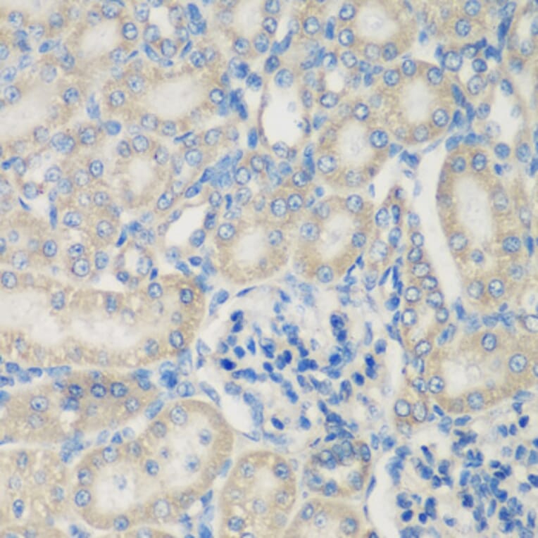 Immunohistochemistry - Anti-C3 Antibody (A15408) - Antibodies.com