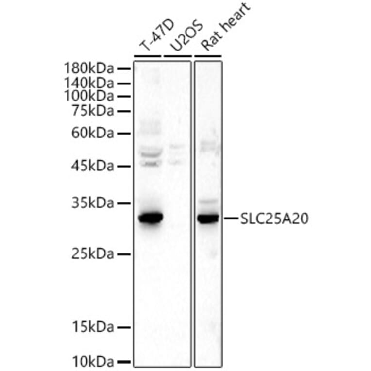 Western Blot - Anti-SLC25A20 Antibody (A15409) - Antibodies.com