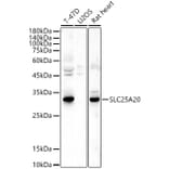 Western Blot - Anti-SLC25A20 Antibody (A15409) - Antibodies.com