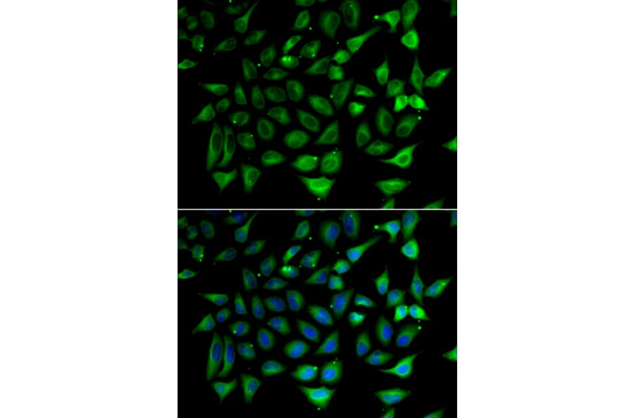 Immunofluorescence - Anti-SLC25A20 Antibody (A15409) - Antibodies.com