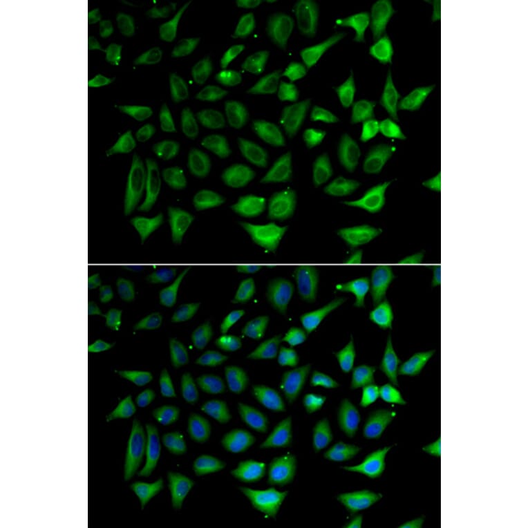 Immunofluorescence - Anti-SLC25A20 Antibody (A15409) - Antibodies.com