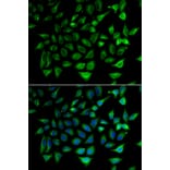 Immunofluorescence - Anti-SLC25A20 Antibody (A15409) - Antibodies.com