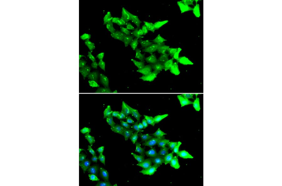 Immunofluorescence - Anti-KRIT1 Antibody (A6881) - Antibodies.com