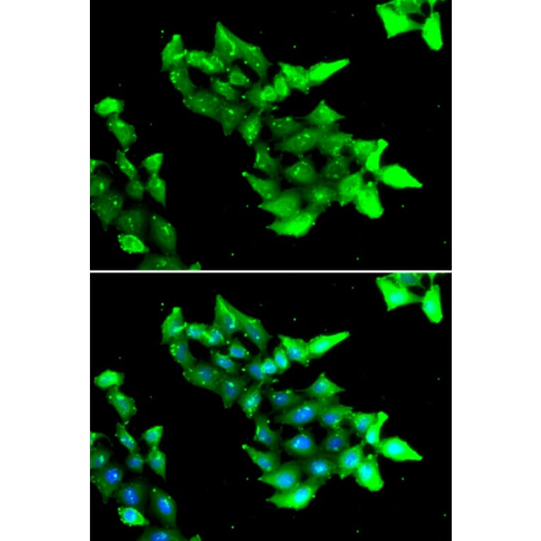 Immunofluorescence - Anti-KRIT1 Antibody (A6881) - Antibodies.com
