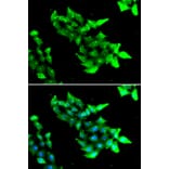 Immunofluorescence - Anti-KRIT1 Antibody (A6881) - Antibodies.com