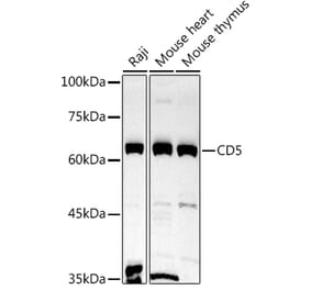 Western Blot - Anti-CD5 Antibody (A15411) - Antibodies.com