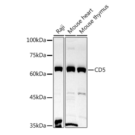 Western Blot - Anti-CD5 Antibody (A15411) - Antibodies.com