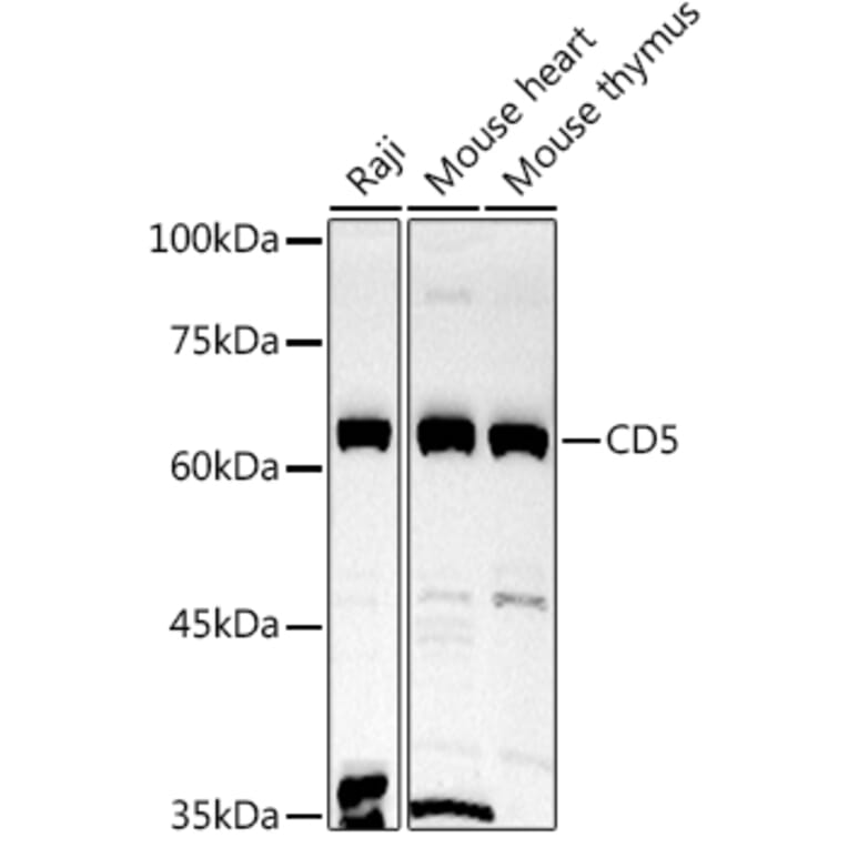 Western Blot - Anti-CD5 Antibody (A15411) - Antibodies.com